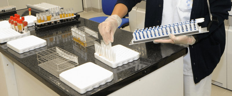 Imagen de archivo de unas pruebas de diagnóstico de viruela del mono / TA